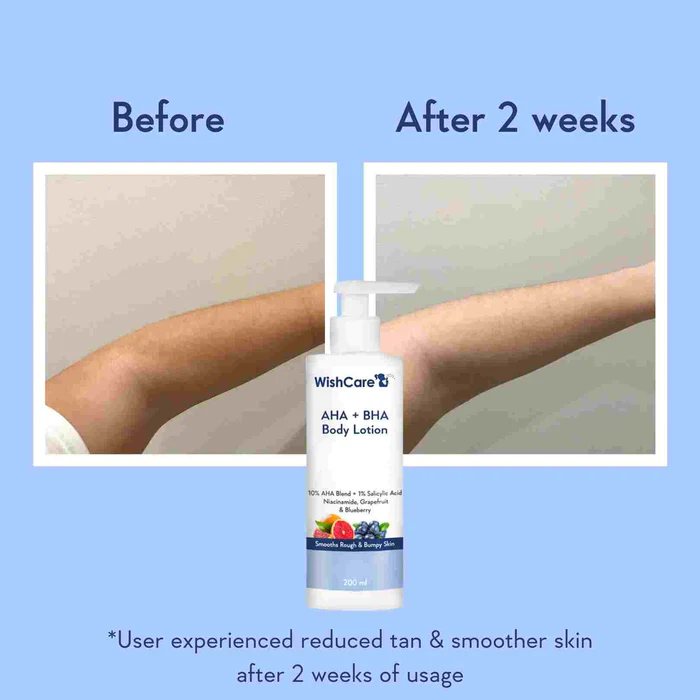 AHA + BHA Body Lotion 200ml - daretoglow.lk